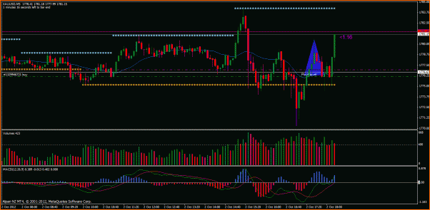 Secciones del Precio en Forex-secchoy.gif